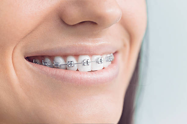 Best Teeth Whitening  in Fairfax, CA